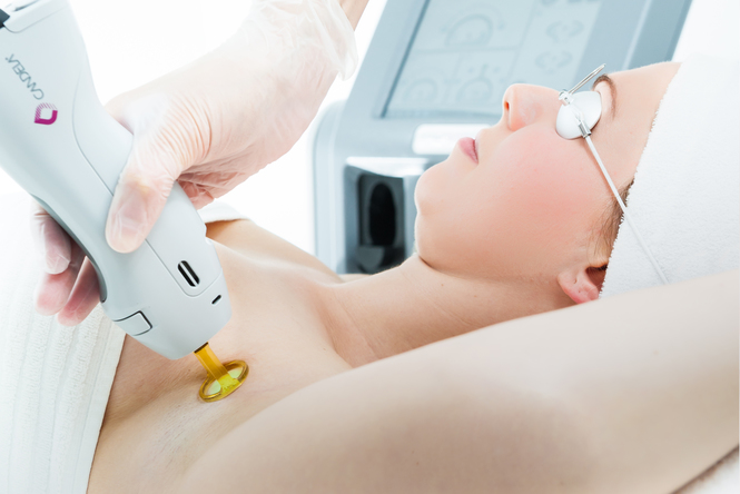 HAIR LASER REMOVAL