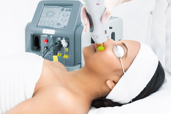 HAIR LASER REMOVAL